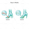 Silicone arch support by Oppo Medical USA (5459) to improve foot comfort | heyzindagi.in- a health & wellness site for differently abled